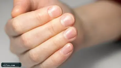 لا تتجاهلها.. علامة في أظافرك تكشف صحتك وتحذر من أمراض صامتة