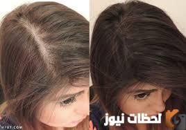 تكثيف وإنبات فراغات الشعر بأسرع الطرق