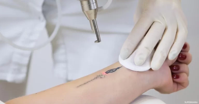 حكم التاتو المؤقت ابن باز