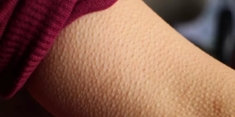 ما الفرق بين جلد الوزة والشعر تحت الجلد؟