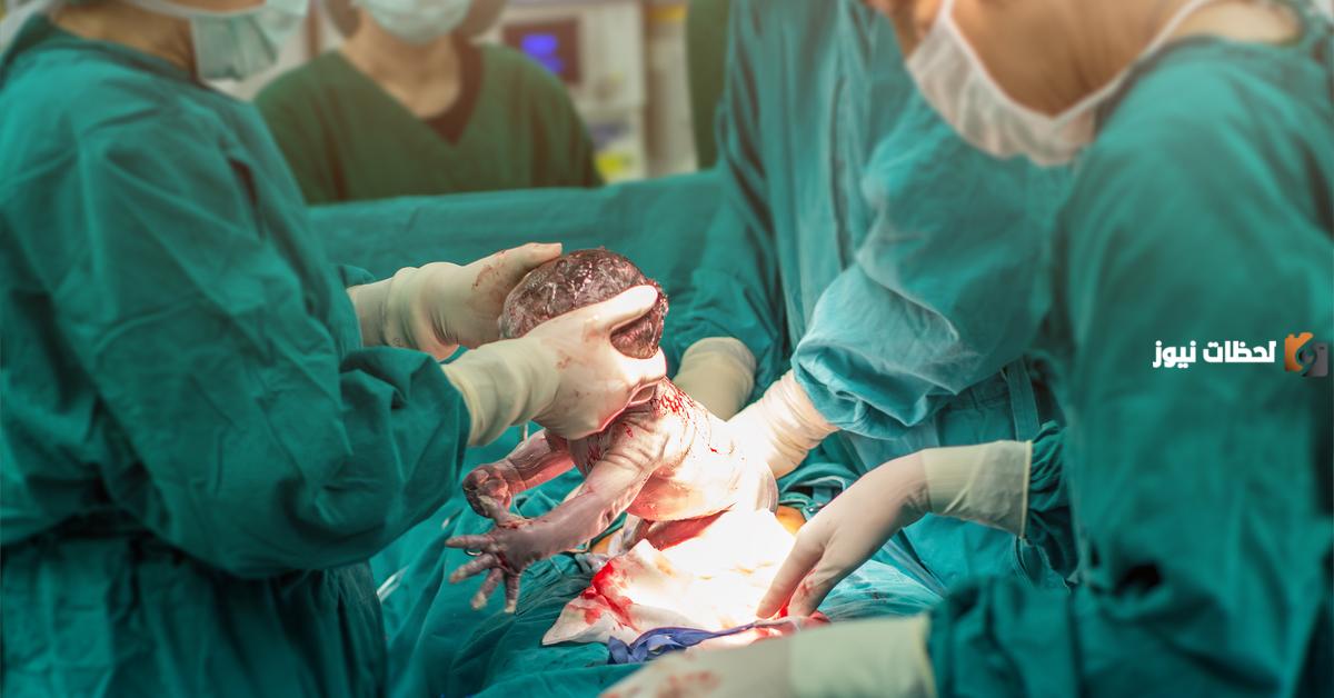الولادة الطبيعية و الولادة القيصرية