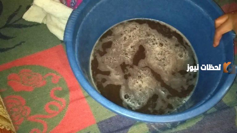 ما هي علامة خروج السحر من الجسم؟