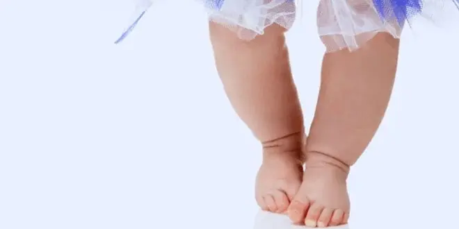 متى يختفي تقوس الساقين عند الأطفال