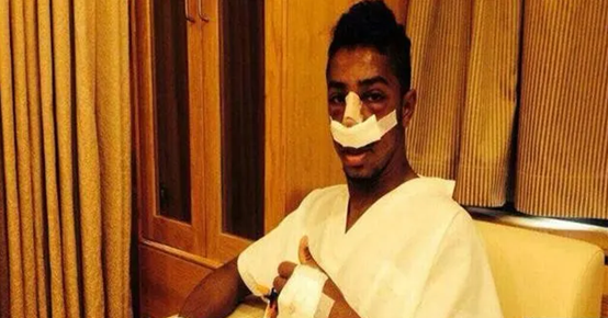 صور سالم الدوسري قبل وبعد العمليات والسيرة الذاتية