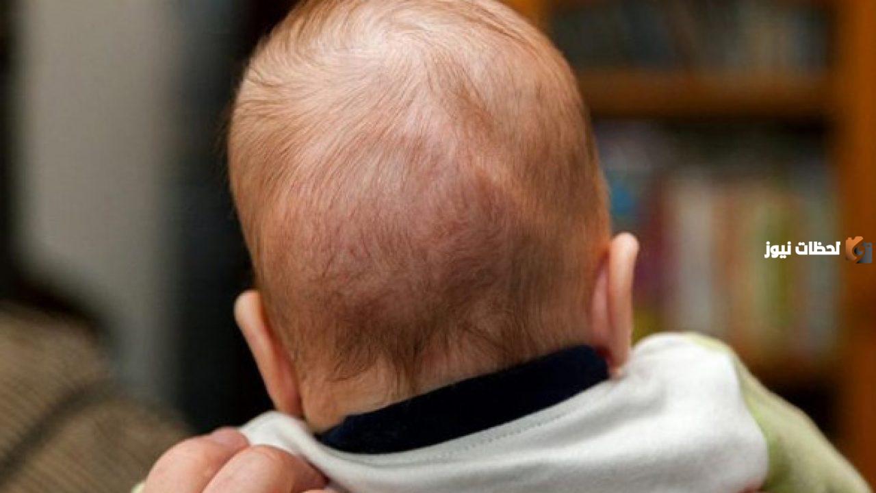 متى يتعدل رأس الطفل الرضيع