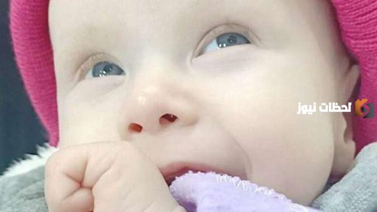 أهم معلومات عن متلازمة مينكيس
