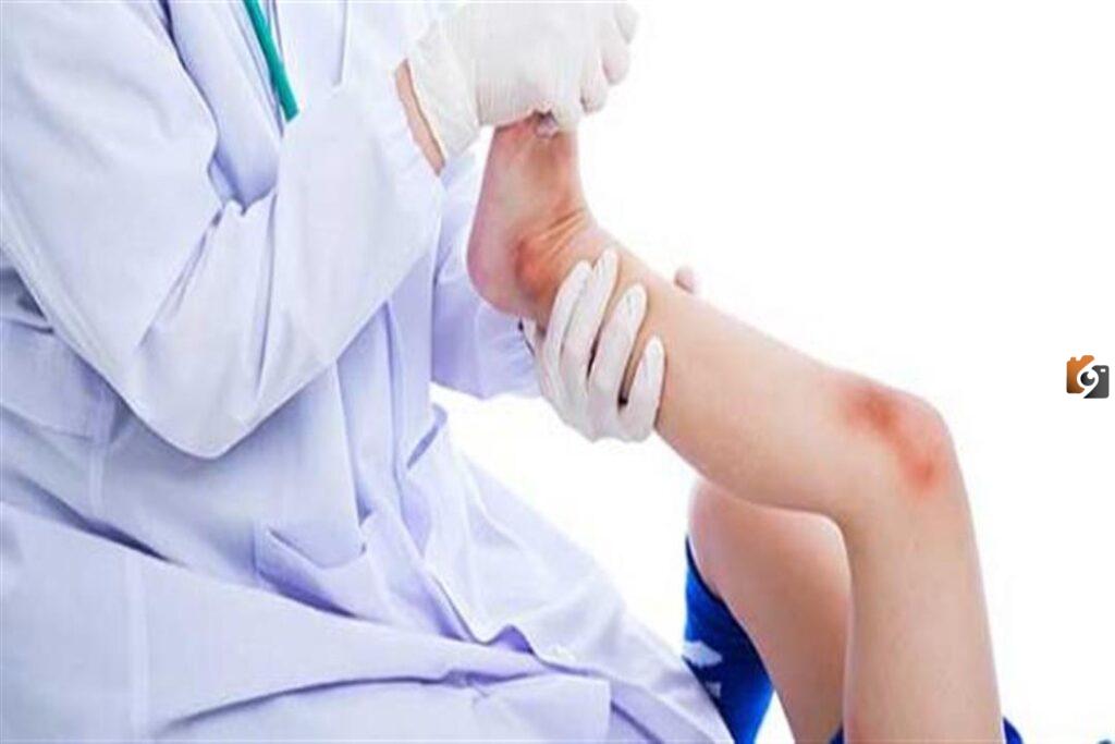 ما هي اسباب توقف نمو العظام عند الأطفال
