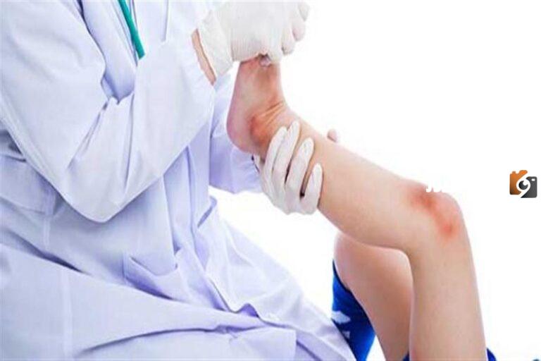 ما هي اسباب توقف نمو العظام عند الأطفال
