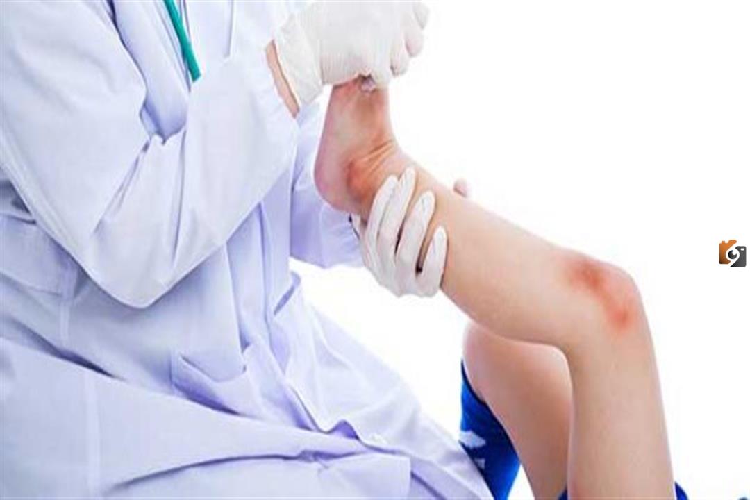 ما هي اسباب توقف نمو العظام عند الأطفال