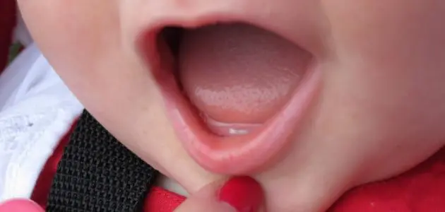 ظهور الأسنان عند الأطفال