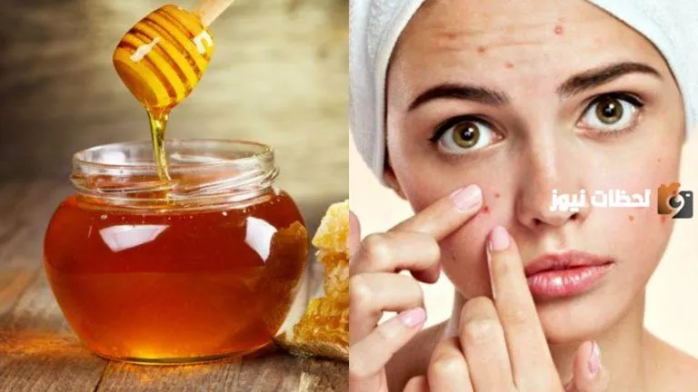 فوائد العسل للبشرة الدهنية