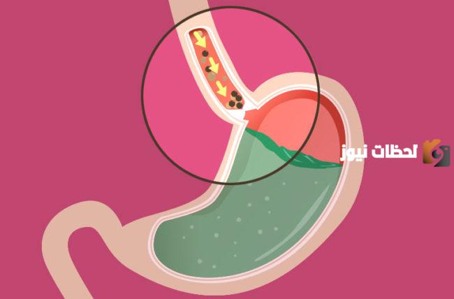 ما هو النظام الغذائي للارتجاع المعدي المريئي عند الأطفال