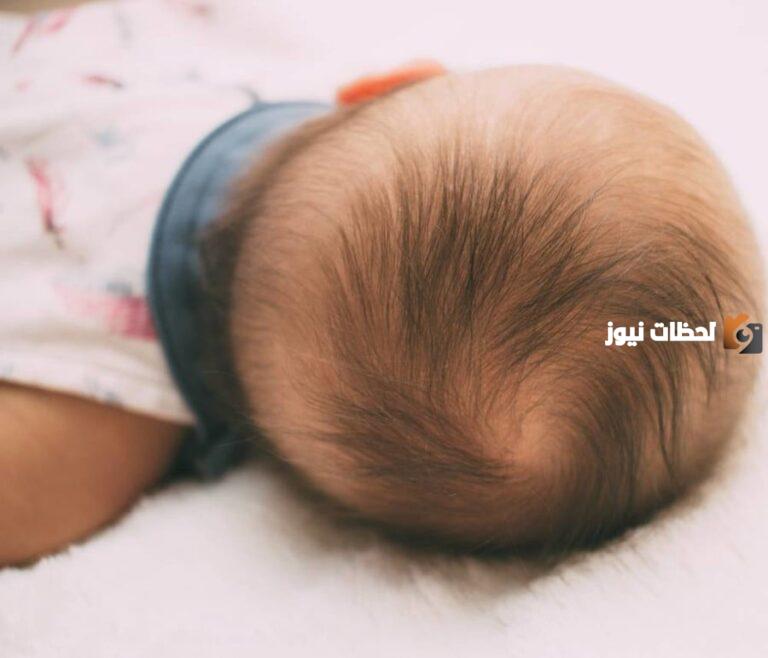 متى يكتمل رأس الرضيع في عمر الشهر الأول
