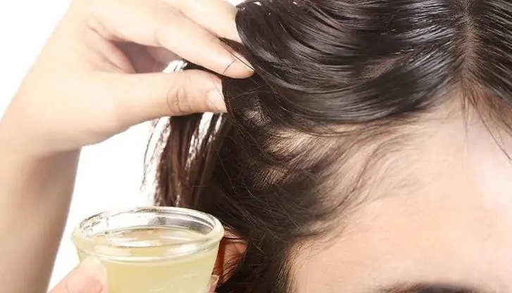 إزالة القشرة من الشعر