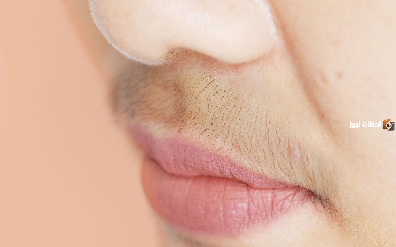 كيف اوقف نمو شعر الذقن عند النساء؟ علاج شعر الذقن عند النساء بالاعشاب