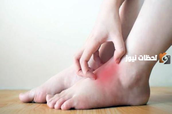 أسباب زيادة اليوريك اسيد ونسبة اليوريك اسيد الخطيرة