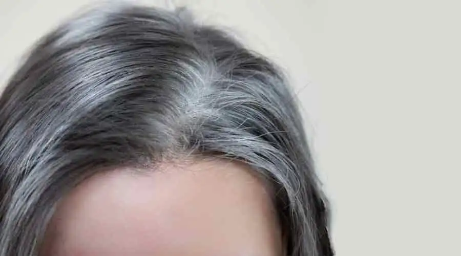 ما اسم عاصمة الصومال وكم تبلغ مساحتها؟