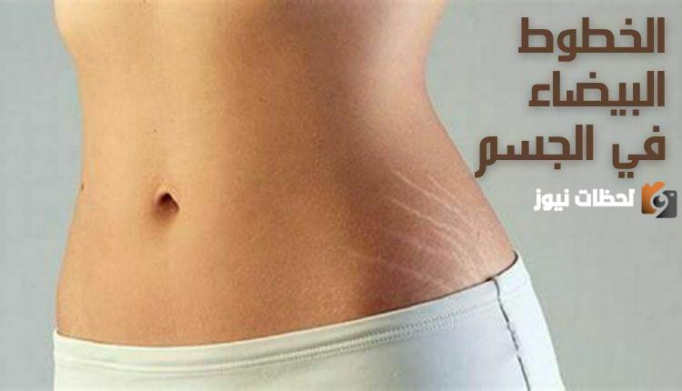 هل الخطوط البيضاء تروح بالليزر