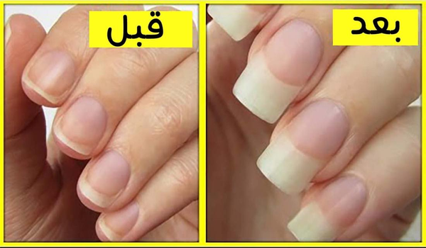 كيف أطول أظافري في يوم واحد فقط