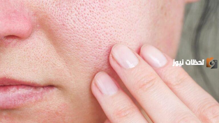 إليك ماسك يصغر المسام وأفضل المكونات المستخدمة ب