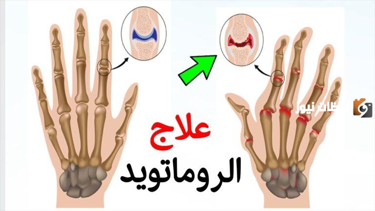 علاج الروماتويد بالاعشاب وقائمة الممنوعات والمسموحات لمرضى الروماتويد