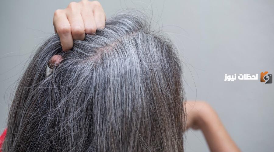 علاج الشعر الأبيض والتخلص منه