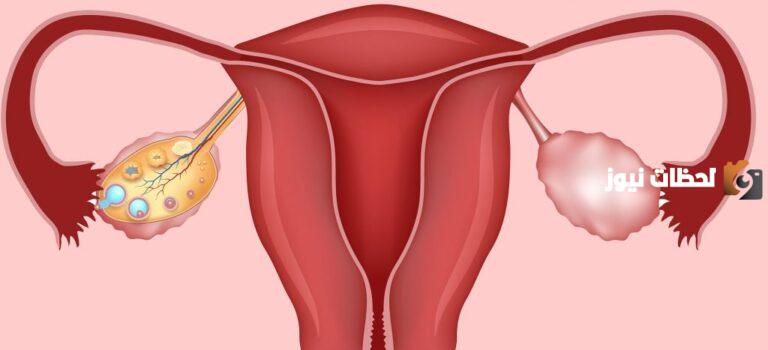 علاج تكيس المبايض بالاعشاب للدكتور جابر القحطاني