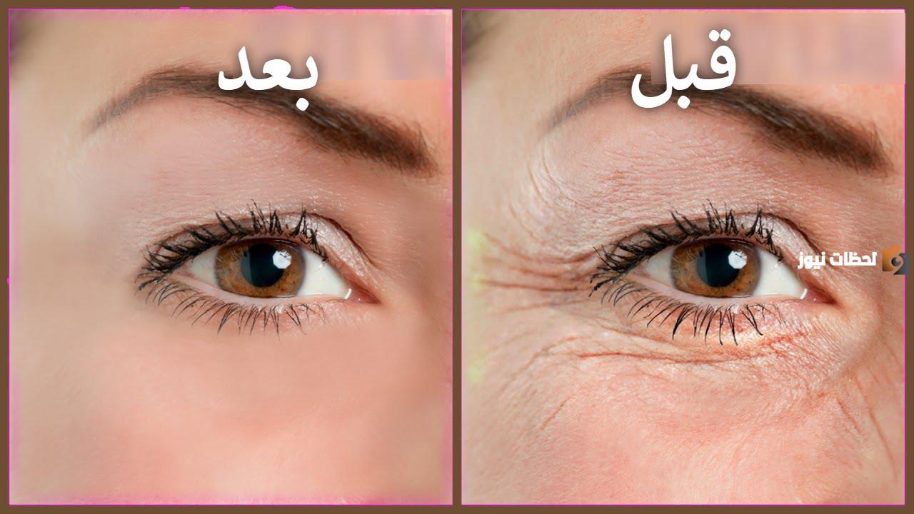 وصفات للتخلص من التجاعيد والانتفاخ تحت العين