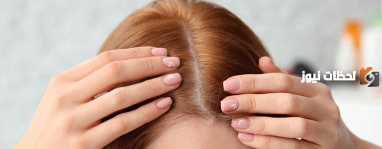 كيف تتم زراعة الشعر
