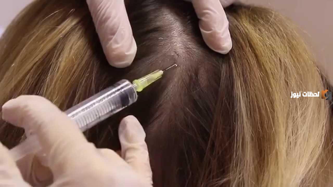هذه فوائد الميزوثيرابي للشعر الخفيف وأضرارة