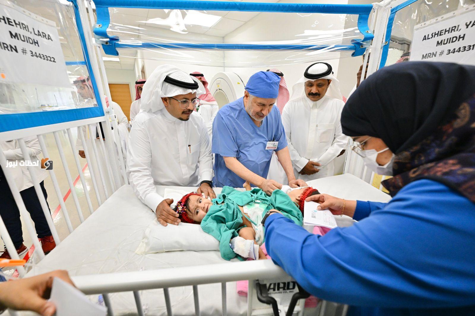 نجاح المرحلة الأولى من فصل التوأم السيامي السعودي يارا ولارا بفضل جهود الأطباء