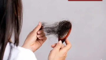 تساقط الشعر