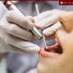 تحقيق استقصائي يثير الجدل حول دور الذكاء الاصطناعي في توصيات علاج الأسنان